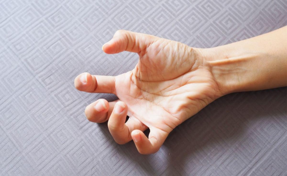 How to act when someone has a seizure?
