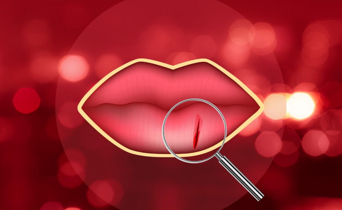 7 Tips for management of lip wounds