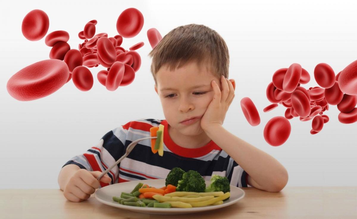 anemia